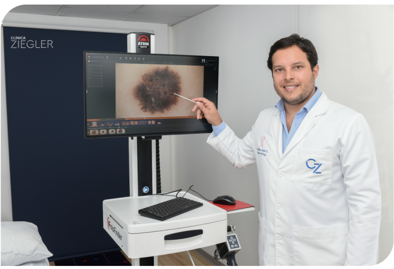Unidad de melanoma y cáncer de píel Clinica Ziegler