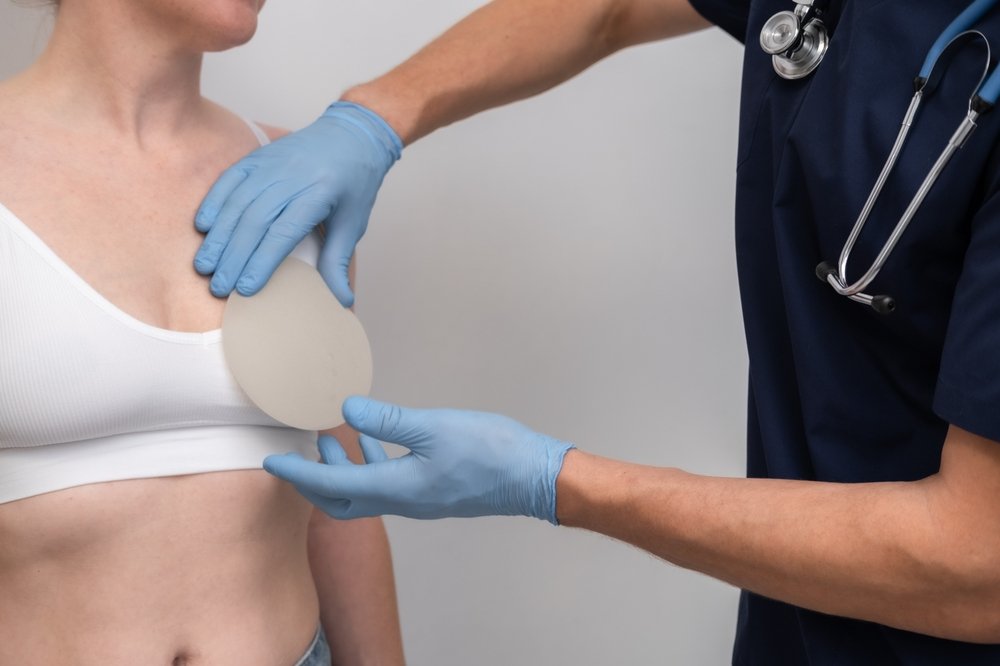 Cambio de Implantes o Prótesis Mamarias