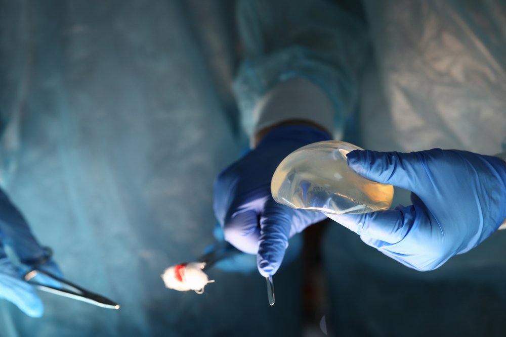 Explante o retiro de implantes mamarios